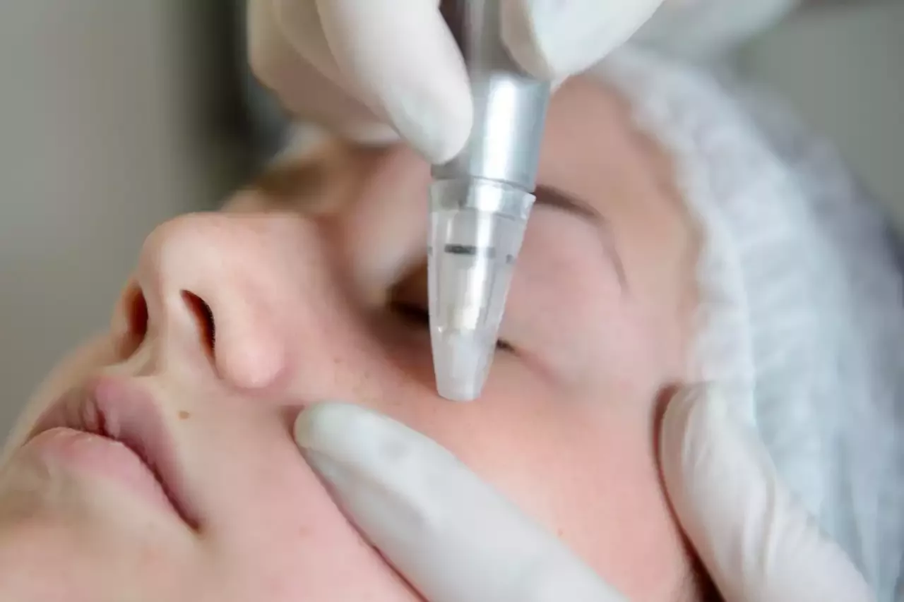 What are the Best Anti-Aging Facial Treatments?